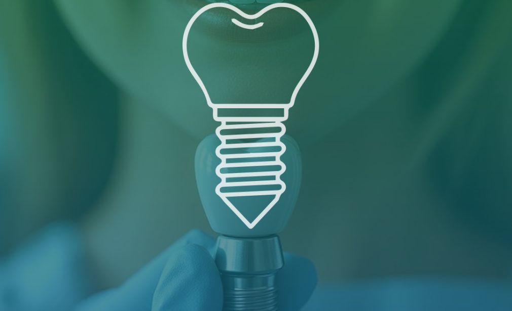 Implant - Clinica Joina Implant - Clinica Joina